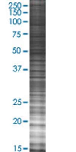 Abnova&trade;&nbsp;DDIT4L 293T Cell Transient Overexpression Lysate (Denatured) (T02)