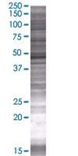 Abnova ZNF689 293T Cell Transient Overexpression Lysate (Denatured) (T01) 100 &mu;l | Buy Online | Abnova&trade; | Fisher Scientific