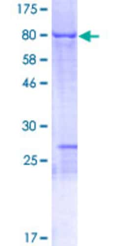 Abnova Human NOSTRIN Full-length ORF (NP_001034813.1, 1 a.a. - 506 a.a.) Recombinant Protein with GST-tag at N-terminal 2 &mu;g | Buy Online | Abnova&trade; | Fisher Scientific