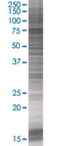 Abnova&trade;&nbsp;RASGRP4 293T Cell Transient Overexpression Lysate (Denatured)