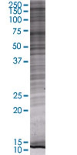 Abnova C1orf24 293T Cell Transient Overexpression Lysate (Denatured) 100&mu;L | Buy Online | Abnova&trade; | Fisher Scientific