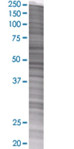 Abnova CYP2R1 293T Cell Transient Overexpression Lysate (Denatured) 100 &mu;L | Buy Online | Abnova&trade; | Fisher Scientific