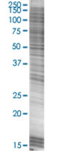 Abnova C12orf46 293T Cell Transient Overexpression Lysate (Denatured) (T03) 100 &mu;L | Buy Online | Abnova&trade; | Fisher Scientific
