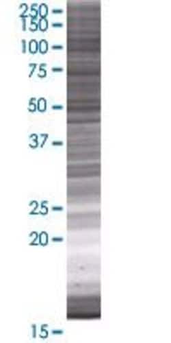 Abnova&trade;&nbsp;RNASE11 293T Cell Transient Overexpression Lysate (Denatured) (T01)