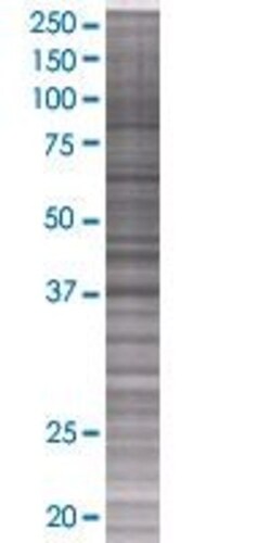 Abnova PPIL5 293T Cell Transient Overexpression Lysate (Denatured) (T01) 100 &mu;L | Buy Online | Abnova&trade; | Fisher Scientific