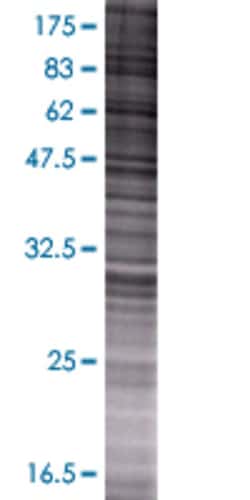 Abnova MTFMT 293T Cell Transient Overexpression Lysate (Denatured) 100 &mu;L | Buy Online | Abnova&trade; | Fisher Scientific