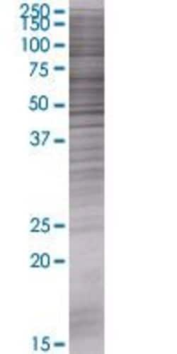 Abnova GGT6 293T Cell Transient Overexpression Lysate (Denatured) (T01) 100 &mu;L | Buy Online | Abnova&trade; | Fisher Scientific