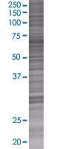 Abnova ATP6V1G3 293T Cell Transient Overexpression Lysate (Denatured) 100 &mu;L | Buy Online | Abnova&trade; | Fisher Scientific