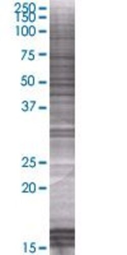 Abnova PODN 293T Cell Transient Overexpression Lysate (Denatured) 100 &mu;L | Buy Online | Abnova&trade; | Fisher Scientific