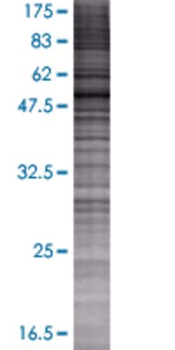 Abnova CPNE4 293T Cell Transient Overexpression Lysate (Denatured) 100 &mu;L | Buy Online | Abnova&trade; | Fisher Scientific