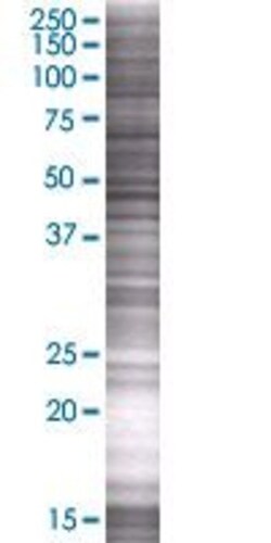 Abnova FAM3D 293T Cell Transient Overexpression Lysate (Denatured) 100 &mu;L | Buy Online | Abnova&trade; | Fisher Scientific