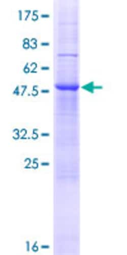 Abnova&trade;&nbsp;Human ZDHHC19 Full-length ORF (AAH34801.1, 1 a.a. - 243 a.a.) Recombinant Protein with GST-tag at N-terminal:  