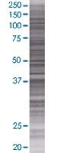 Abnova ZFP42 293T Cell Transient Overexpression Lysate (Denatured) 100 &mu;L | Buy Online | Abnova&trade; | Fisher Scientific
