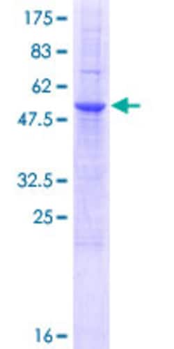 Abnova Human RAET1E Full-length ORF (AAI03695.1, 1 a.a. - 263 a.a.) Recombinant Protein with GST-tag at N-terminal 25 &mu;g | Buy Online | Abnova&trade; | Fisher Scientific
