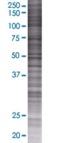 Abnova AGPAT6 293T Cell Transient Overexpression Lysate (Denatured) 100 &mu;L | Buy Online | Abnova&trade; | Fisher Scientific