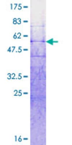 Abnova Human RNF32 Full-length ORF (AAH28120.1, 1 a.a. - 256 a.a.) Recombinant Protein with GST-tag at N-terminal 2 &mu;g | Buy Online | Abnova&trade; | Fisher Scientific