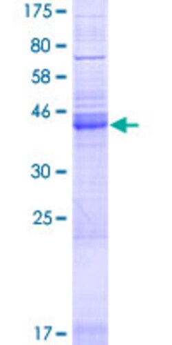Abnova Human NRSN1 Full-length ORF (AAH23514.1, 1 a.a. - 195 a.a.) Recombinant Protein with GST-tag at N-terminal 10 &mu;g | Buy Online | Abnova&trade; | Fisher Scientific