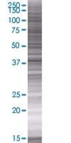 Abnova HAPLN3 293T Cell Transient Overexpression Lysate (Denatured) 100 &mu;L | Buy Online | Abnova&trade; | Fisher Scientific