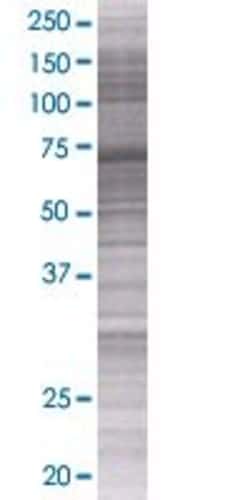 Abnova ZNF582 293T Cell Transient Overexpression Lysate (Denatured) 100 &mu;L | Buy Online | Abnova&trade; | Fisher Scientific