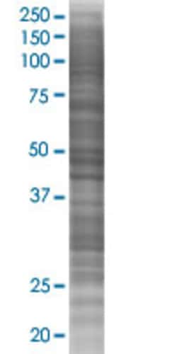 Abnova&trade;&nbsp;UBE2U 293T Cell Transient Overexpression Lysate (Denatured)