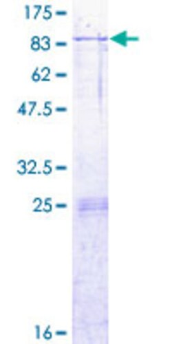 Abnova Human ARSK Full-length ORF (NP_937793.1, 1 a.a. - 536 a.a.) Recombinant Protein with GST-tag at N-terminal 2 &mu;g | Buy Online | Abnova&trade; | Fisher Scientific