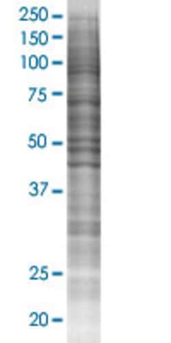 Abnova&trade;&nbsp;DYX1C1 293T Cell Transient Overexpression Lysate (Denatured)
