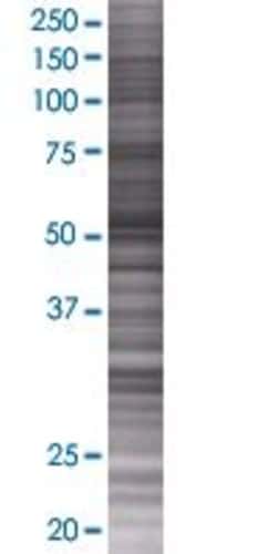 Abnova KRT25D 293T Cell Transient Overexpression Lysate (Denatured) 100&mu;L | Buy Online | Abnova&trade; | Fisher Scientific