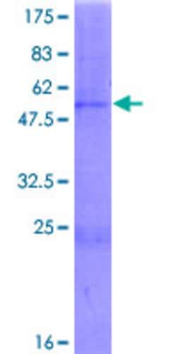 Abnova Human CHST13 Full-length ORF (AAI03897.1, 1 a.a. - 225 a.a.) Recombinant Protein with GST-tag at N-terminal 2 &mu;g | Buy Online | Abnova&trade; | Fisher Scientific