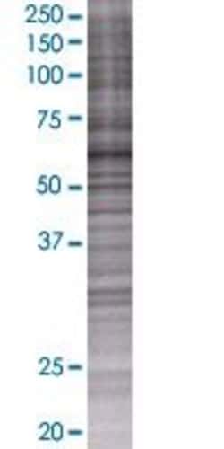 Abnova MGC27016 293T Cell Transient Overexpression Lysate (Denatured) 100 &mu;l | Buy Online | Abnova&trade; | Fisher Scientific