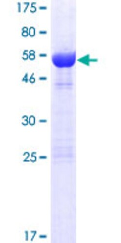 Abnova&trade;&nbsp;Human LIX1 Full-length ORF (NP_694966.2, 1 a.a. - 282 a.a.) Recombinant Protein with GST-tag at N-terminal:  