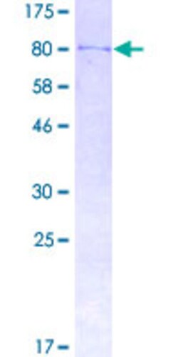 Abnova™ Human DDX53 Full-length ORF (AAH67878.1, 1 a.a. - 631 a.a.) Recombinant Protein with GST-tag at N-terminal