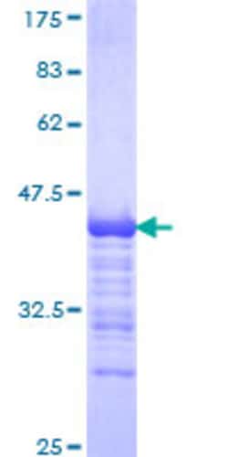 Abnova Human SSBP4 Partial ORF (NP_116016, 135 a.a. - 244 a.a.) Recombinant Protein with GST-tag at N-terminal 25 &mu;g | Buy Online | Abnova&trade; | Fisher Scientific
