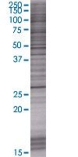 Abnova KCTD6 293T Cell Transient Overexpression Lysate (Denatured) (T01) 100 &mu;L | Buy Online | Abnova&trade; | Fisher Scientific