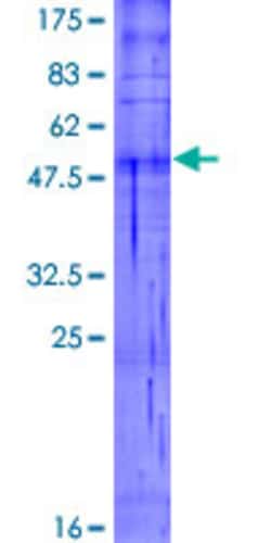 Abnova Human OR5R1 Full-length ORF (NP_001004744.1, 1 a.a. - 324 a.a.) Recombinant Protein with GST-tag at N-terminal 2 &mu;g | Buy Online | Abnova&trade; | Fisher Scientific