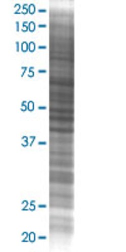 Abnova RFXDC1 293T Cell Transient Overexpression Lysate (Denatured) (T02) 100 &mu;L | Buy Online | Abnova&trade; | Fisher Scientific