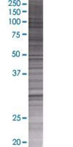 Abnova PHYHD1 293T Cell Transient Overexpression Lysate (Denatured) 100 &mu;L | Buy Online | Abnova&trade; | Fisher Scientific