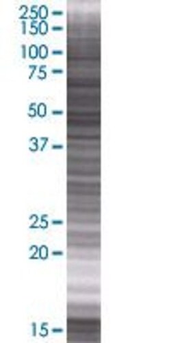 Abnova ZNF549 293T Cell Transient Overexpression Lysate (Denatured) (T01) 100 &mu;l | Buy Online | Abnova&trade; | Fisher Scientific