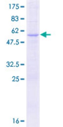 Abnova&trade;&nbsp;Human FLJ37201 Full-length ORF (AAH43217.1, 1 a.a. - 199 a.a.) Recombinant Protein with GST-tag at N-terminal 25&mu;g 