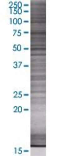 Abnova PLA2G4D 293T Cell Transient Overexpression Lysate (Denatured) (T01) 100 &mu;L | Buy Online | Abnova&trade; | Fisher Scientific