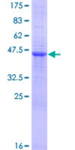 Abnova Human UNQ3033 Full-length ORF (AAI00943.1, 1 a.a. - 174 a.a.) Recombinant Protein with GST-tag at N-terminal 10 &mu;g | Buy Online | Abnova&trade; | Fisher Scientific