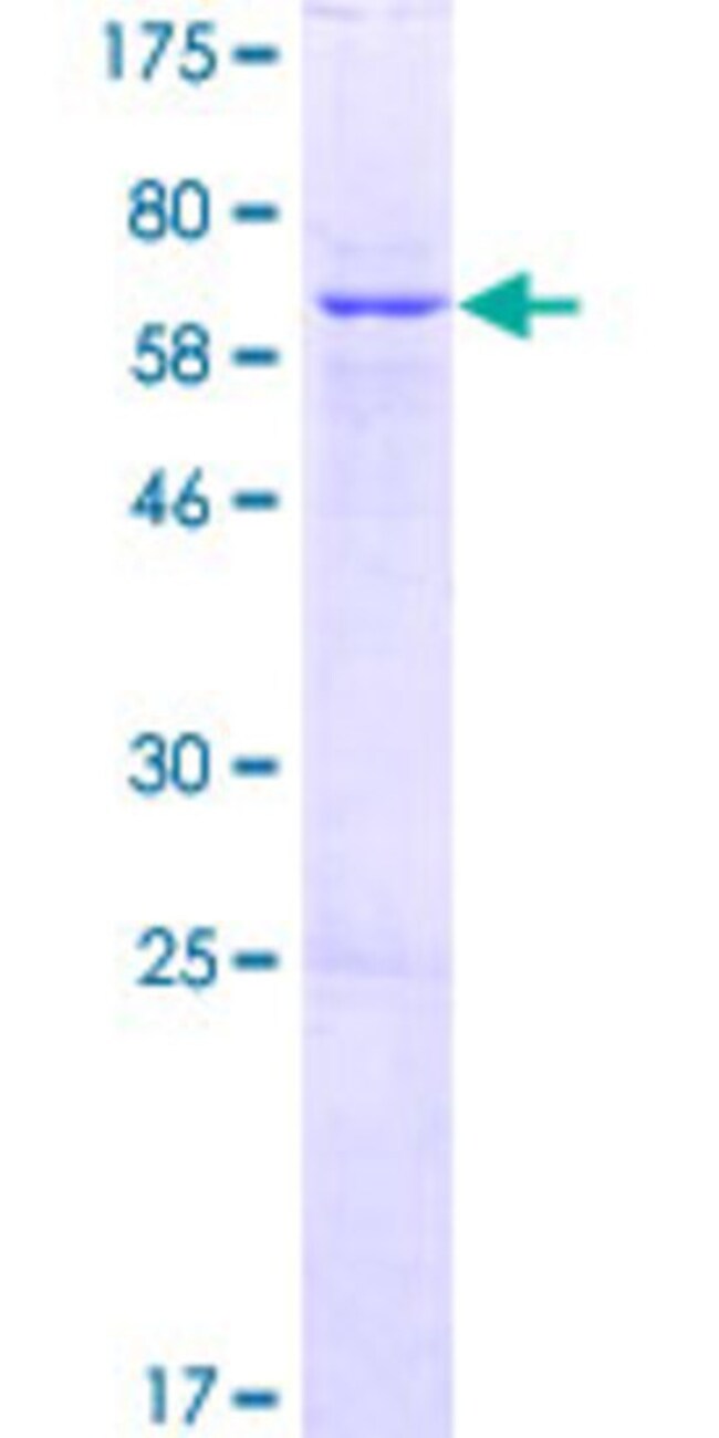 Abnova Human Znf707 Full Length Orf Np 1 1 A A 369 A A Recombinant Protein With Gst At N Terminal 2mg Proteins Xyz Fisher Scientific