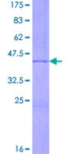 Abnova Human HIST2H3A Full-length ORF (NP_001005464.1, 1 a.a. - 136 a.a.) Recombinant Protein with GST-tag at N-terminal 2 &mu;g | Buy Online | Abnova&trade; | Fisher Scientific