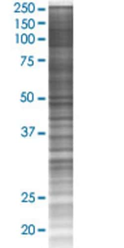 Abnova SYCN 293T Cell Transient Overexpression Lysate (Denatured) 100 &mu;L | Buy Online | Abnova&trade; | Fisher Scientific