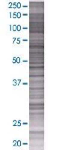 Abnova AMIGO2 293T Cell Transient Overexpression Lysate (Denatured) 100 &mu;L | Buy Online | Abnova&trade; | Fisher Scientific