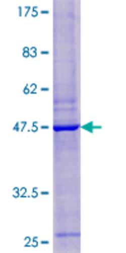 Abnova Human ANKRD36 Full-length ORF (NP_940957.3, 1 a.a. - 163 a.a.) Recombinant Protein with GST-tag at N-terminal 25 &mu;g | Buy Online | Abnova&trade; | Fisher Scientific