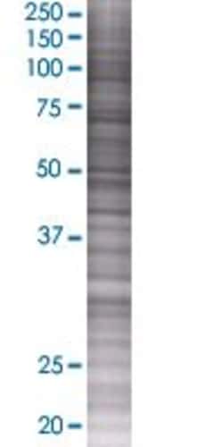 Abnova TMEM82 293T Cell Transient Overexpression Lysate (Denatured) 100 &mu;L | Buy Online | Abnova&trade; | Fisher Scientific