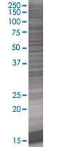 Abnova MAP1LC3C 293T Cell Transient Overexpression Lysate (Denatured) 100 &mu;L | Buy Online | Abnova&trade; | Fisher Scientific