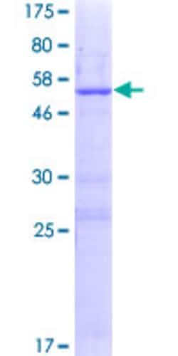 Abnova™ Human LRRC18 Full-length ORF (NP_001006940.2, 1 a.a. - 261 a.a.) Recombinant Protein with GST-tag at N-terminal