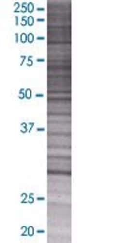Abnova TRIM72 293T Cell Transient Overexpression Lysate (Denatured) 100 &mu;L | Buy Online | Abnova&trade; | Fisher Scientific