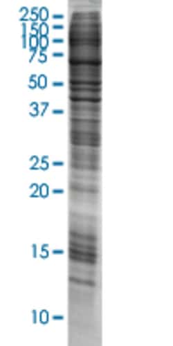 Abnova™ ANXA3 HEK293 Cell Transient Overexpression Lysate (Nondenatured)